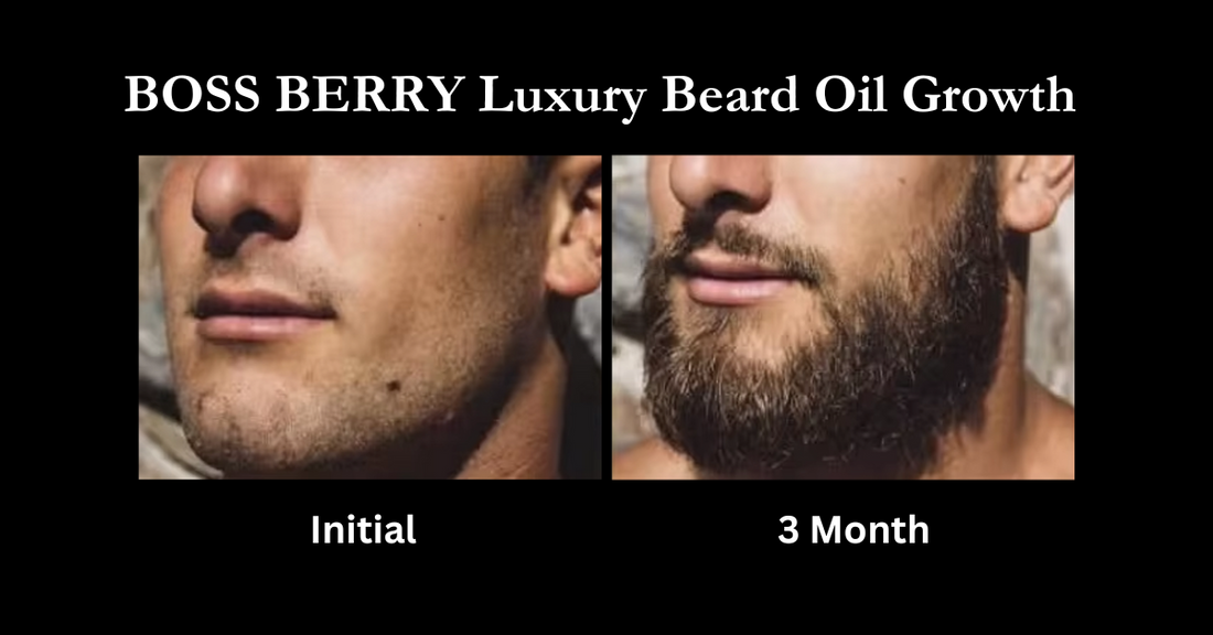 BOSS BERRY Beard Oil Beard Growth 3 mo.